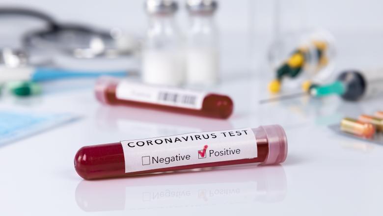 În România cazurile confirmate, de coronavirus