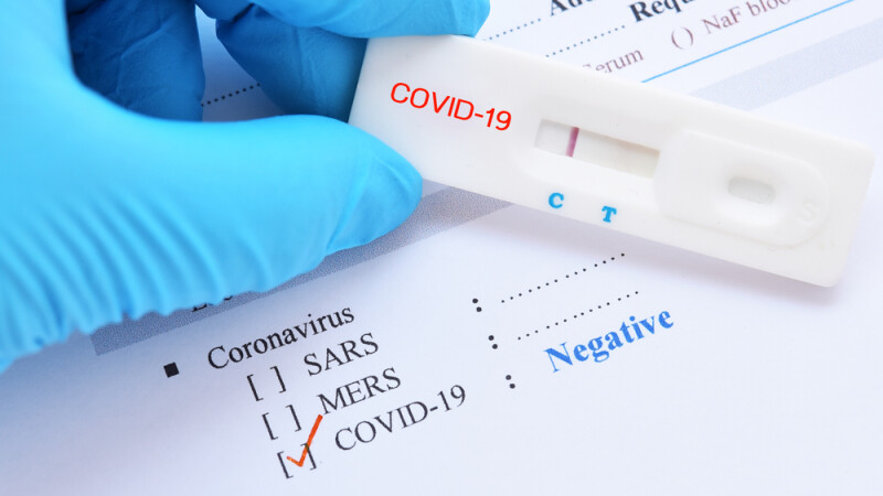 Medicii de la Harvard susține că poate opri epidemia de COVID cu ceva ce costă...1 dolar