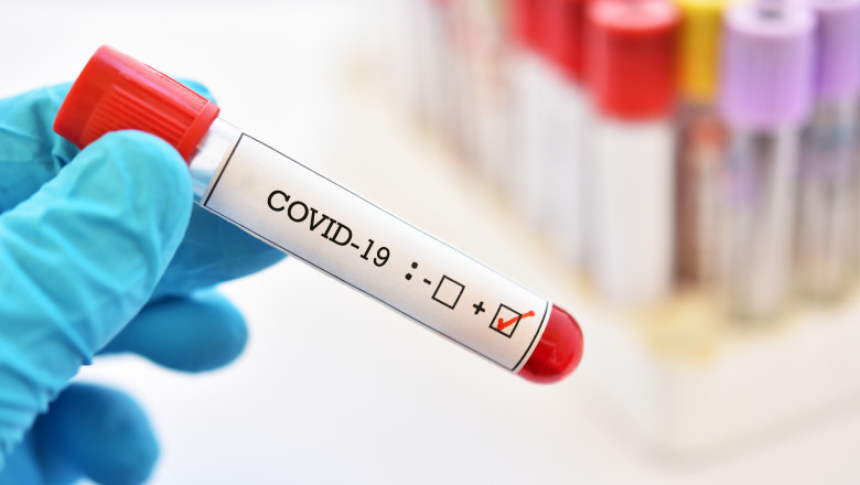 Rata de pozitivare depășește din nou 30% din testele COVID, pozitive