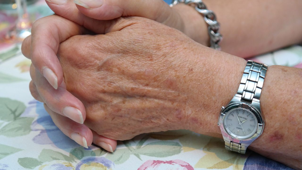 Un nou simptom bizar al infecţiei cu coronavirus iese la iveală